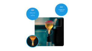 Platelet RICH Plasma (PRP)